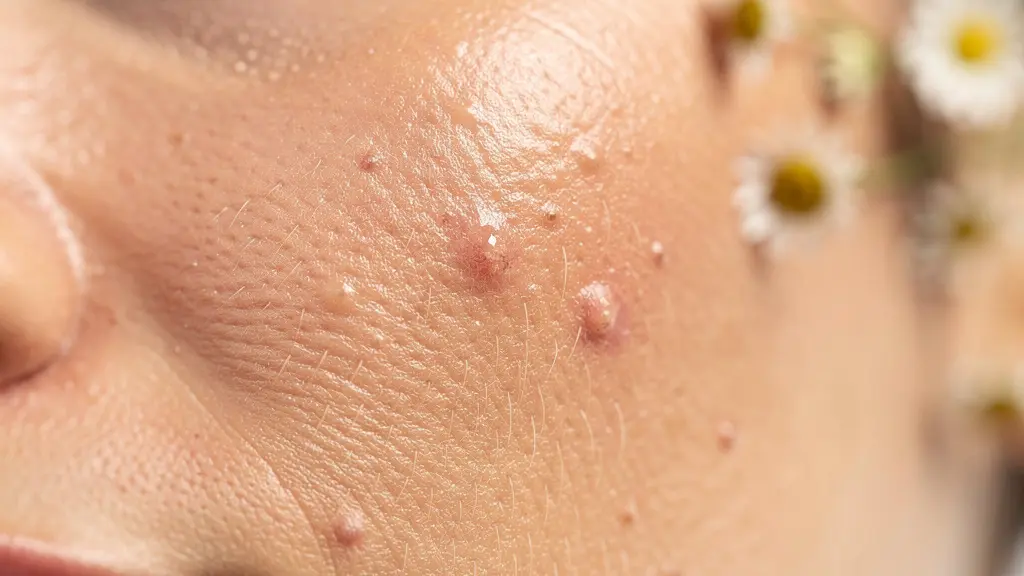 Makroaufnahme von Haut während der Umstellungsphase auf Naturkosmetik